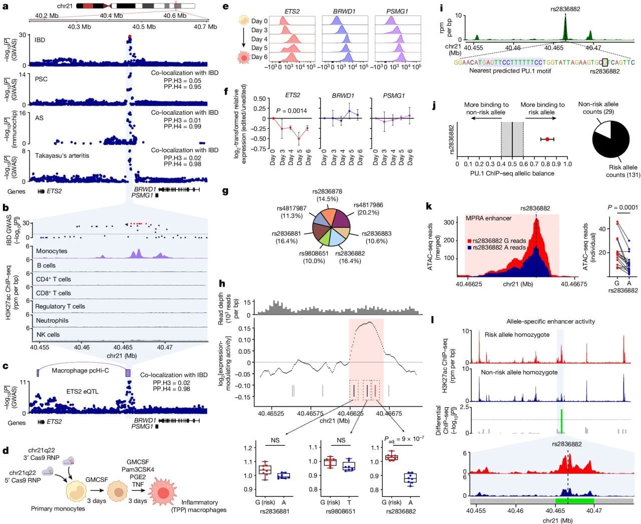 A new genetic cause for Inflammatory Bowel Disease has been discovered