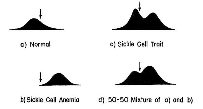 Linus Pauling molecularly characterized the first Mendelian Disease: Sickle Cell Anemia