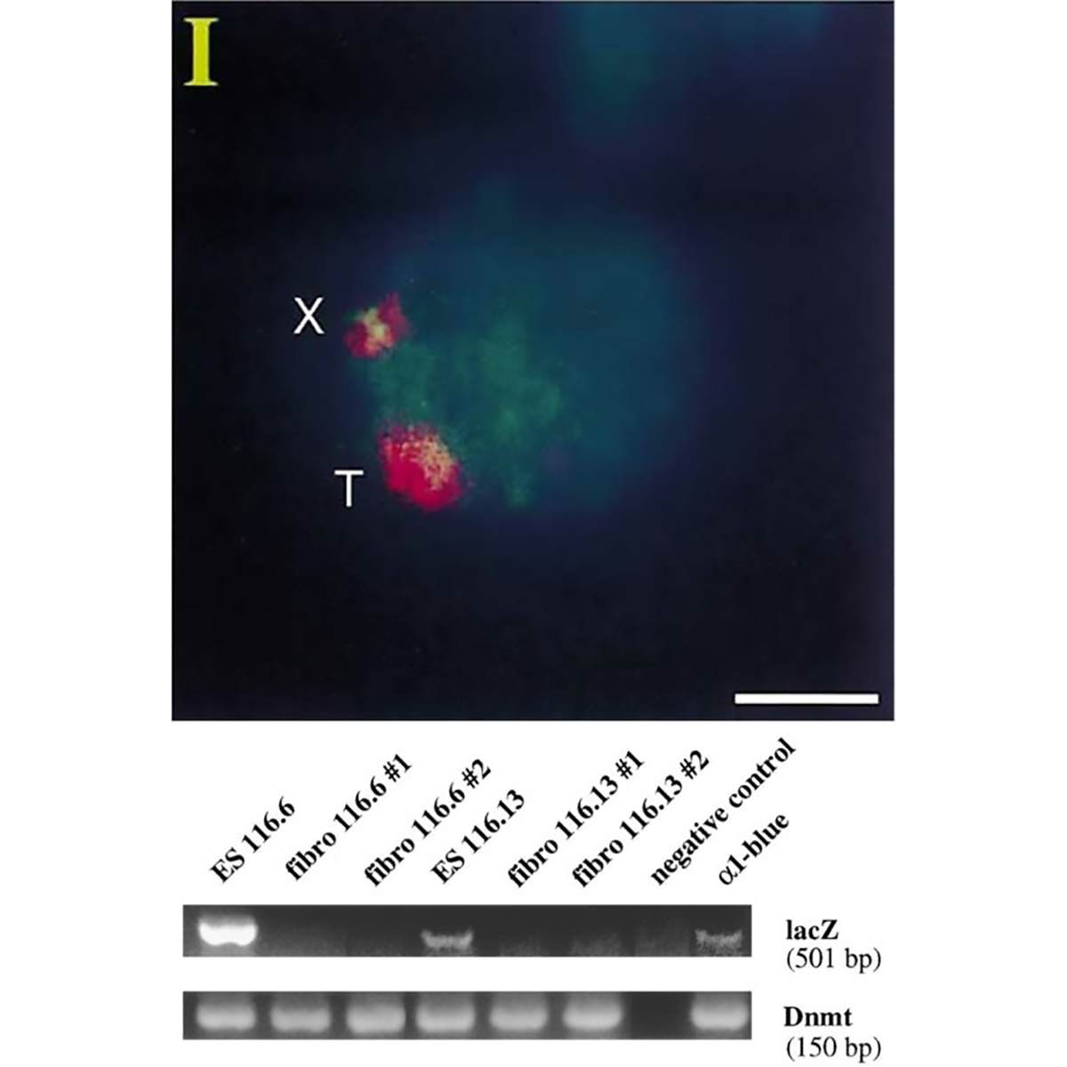 The discovery that X-inactivation is caused by a long non-coding RNA