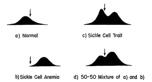 Sickle Cell Anemia was molecularly characterized in 1949 using a revolutionary new technique: electrophoresis