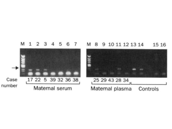 A multi-billion dollar industry was spawned from the discovery of circulating free DNA