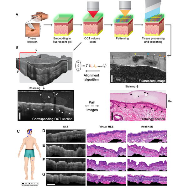 Coming to a dermatologist near you: The microscope will see you now.