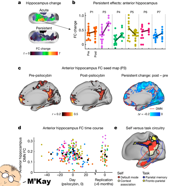 Need to reset your brain? It might be time to go on a trip