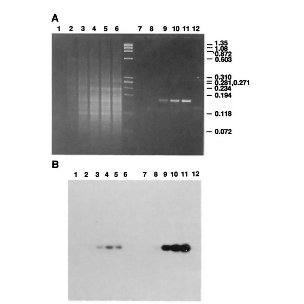 Who discovered PCR first? The answer might surprise you